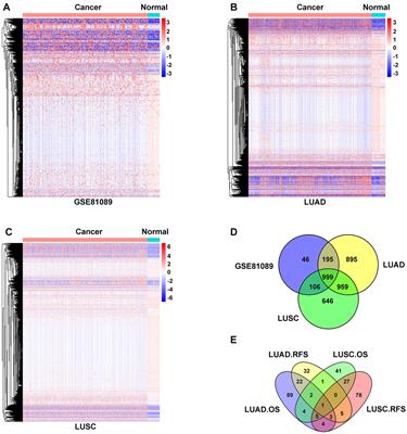 LINC02678 as a Novel Prognostic Marker Promotes Aggressive Non-small-cell Lung Cancer